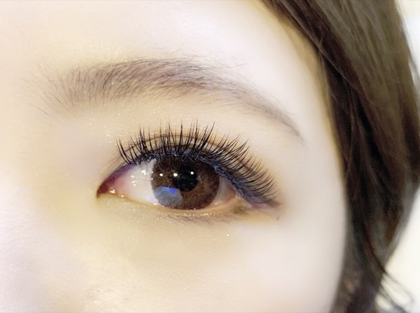 施術例4 - ダブルフラットラッシュ